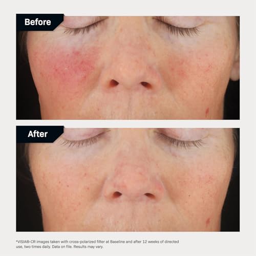 Revision-Skincare-C-Correcting-Complex-30-Vitamin-C-Serum-for-Face--Anti-Aging-Treatment-to-Brighten-Skin-Reduce-Fine-Lines-Wrinkles-Dark-Spots-Firming-Safe-for-Sensitive-Skin-0-3